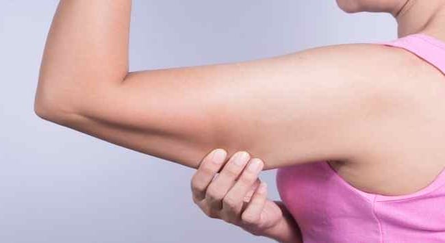 Hút mỡ cánh tay có đau không?